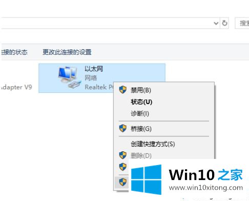 win10以太网在哪里的详细解决方式