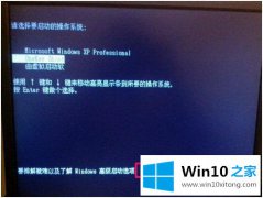 手把手解决win10分辩率太高黑屏的处理要领